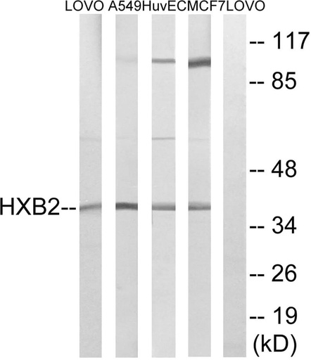 Antibodie to-HOXB2 