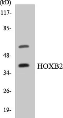 Antibodie to-HOXB2  - Identical to Abcam (ab136856)