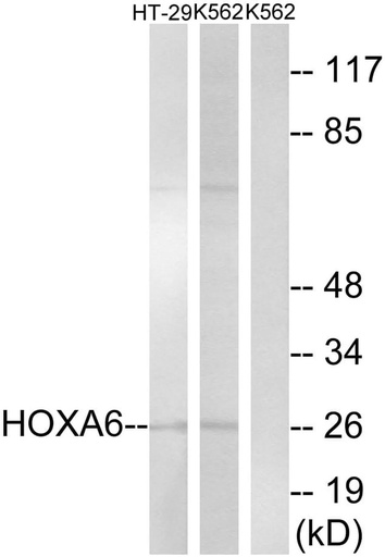 Antibodie to-HOXA6 