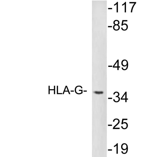 Antibodie to-HLA-G 
