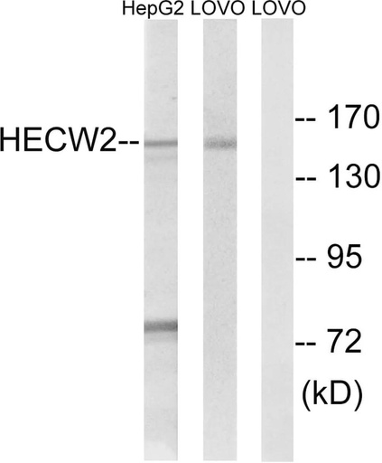 Antibodie to-HECW2 