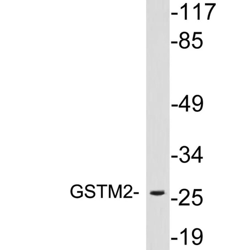 Antibodie to-GSTM2 