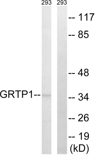 Antibodie to-GRTP1 