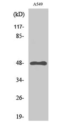 Antibodie to-GPR83 