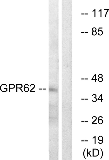 Antibodie to-GPR62 