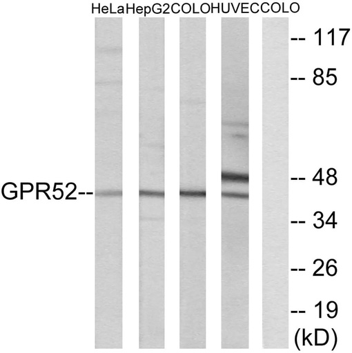 Antibodie to-GPR52 