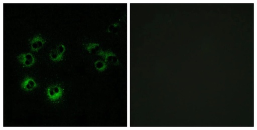Antibodie to-GPR42 