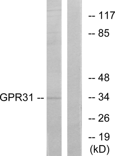Antibodie to-GPR31 