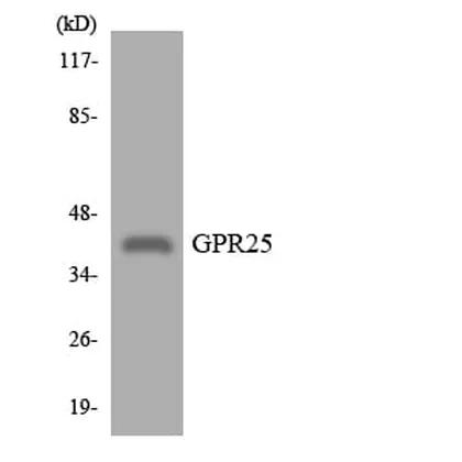 Antibodie to-GPR25 