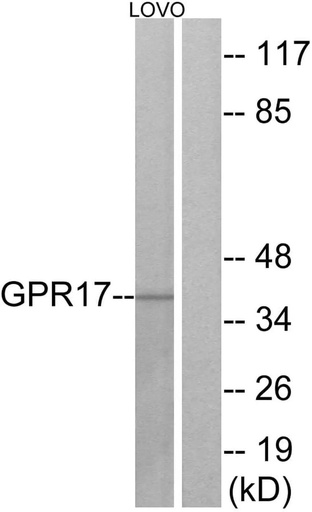 Antibodie to-GPR17 
