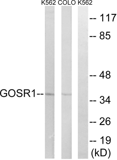 Antibodie to-GOSR1 