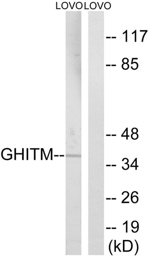 Antibodie to-GHITM 