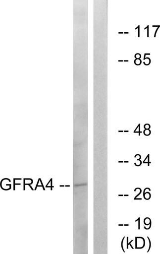 Antibodie to-GFRA4 