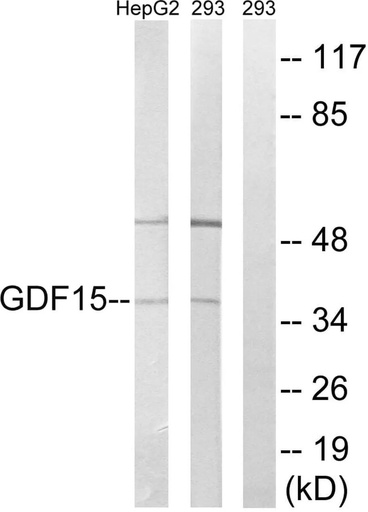 Antibodie to-GDF15 