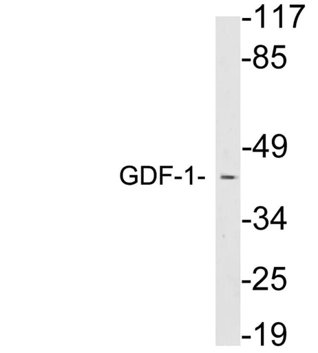 Antibodie to-GDF-1 