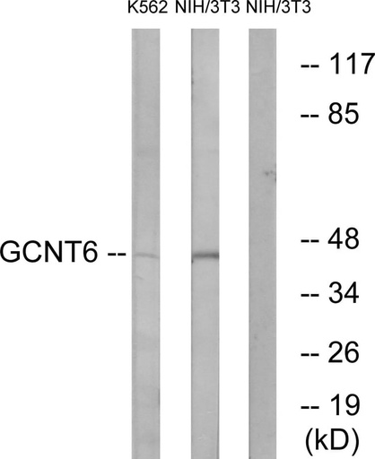 Antibodie to-GCNT6 