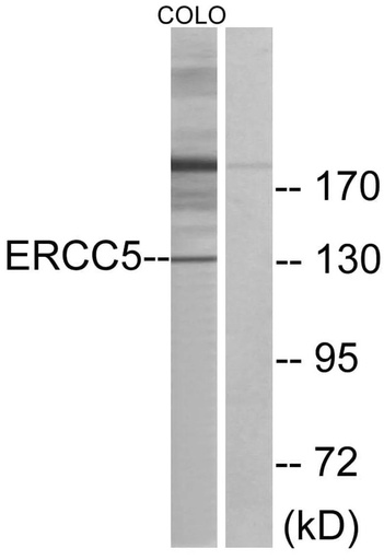 Antibodie to-ERCC5  - Identical to Abcam (ab189317)