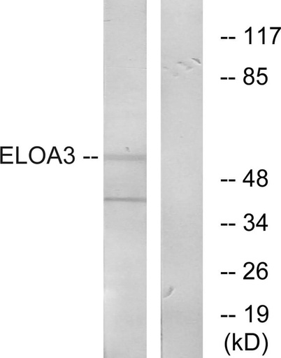 Antibodie to-ELOA3 