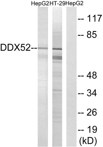 Antibodie to-DDX52 