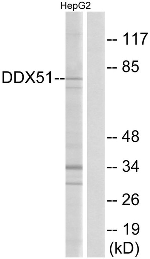Antibodie to-DDX51 
