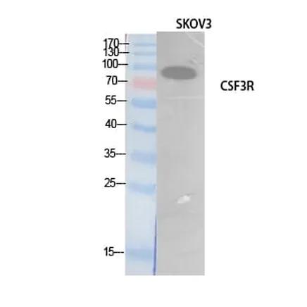 Antibodie to-CSF3R 