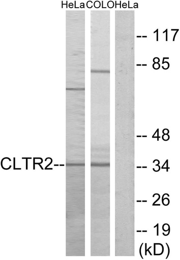 Antibodie to-CLTR2 
