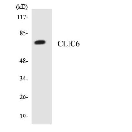 Antibodie to-CLIC6 