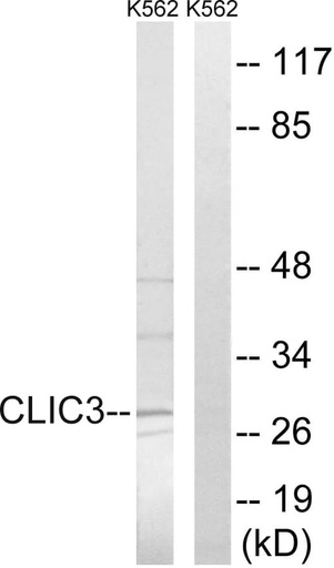 Antibodie to-CLIC3 
