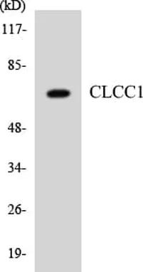 Antibodie to-CLCC1 