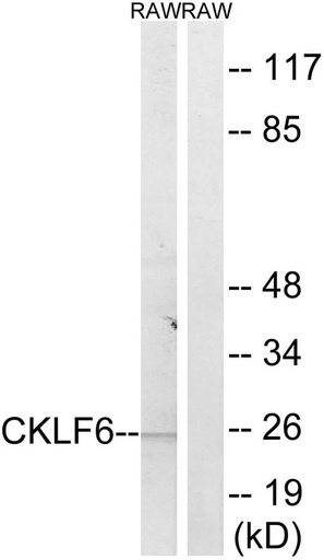 Antibodie to-CKLF6 