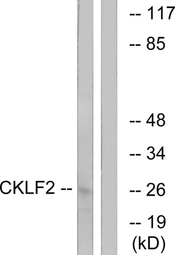 Antibodie to-CKLF2 
