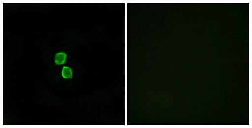 Antibodie to-CKLF1  - Identical to Abcam (ab196804)