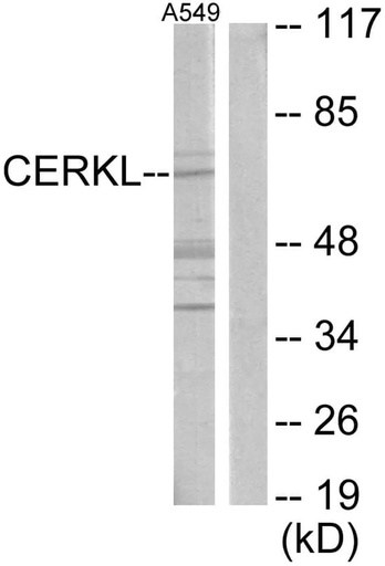 Antibodie to-CERKL 