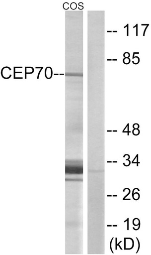 Antibodie to-CEP70 