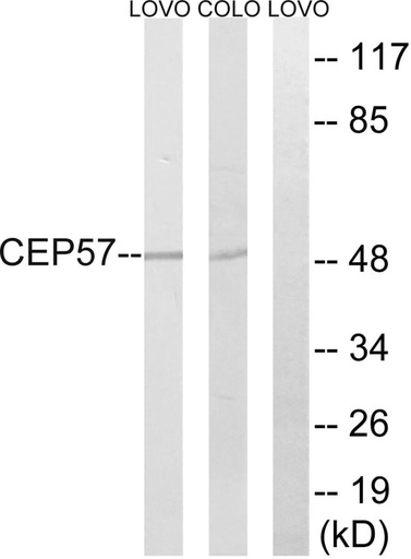 Antibodie to-CEP57 