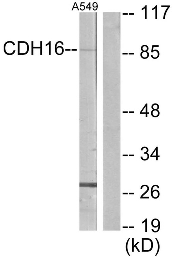 Antibodie to-CDH16 