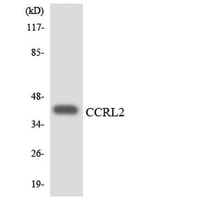 Antibodie to-CCRL2 