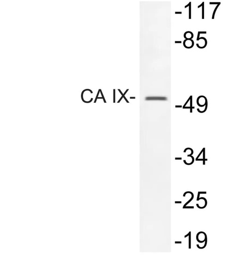Antibodie to-CA IX 
