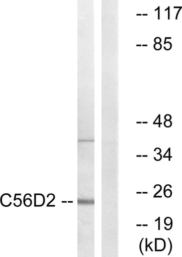 Antibodie to-C56D2 