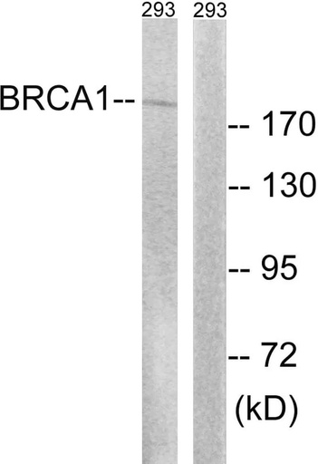 Antibodie to-BRCA1 