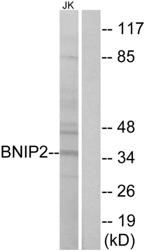 Antibodie to-BNIP2 