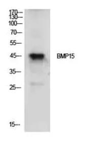 Antibodie to-BMP15 