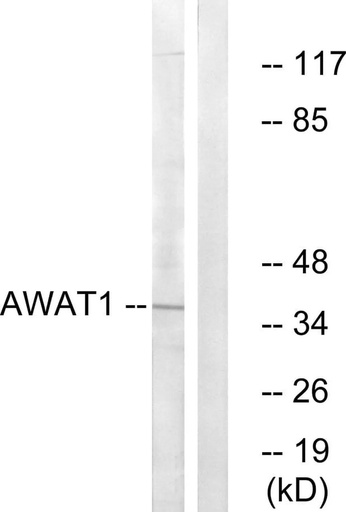 Antibodie to-AWAT1 