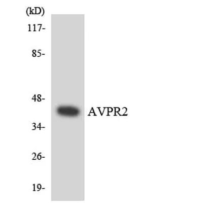 Antibodie to-AVPR2 