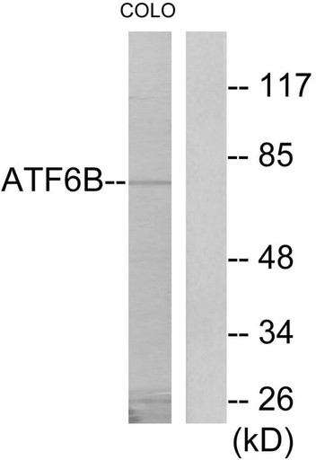 Antibodie to-ATF6B 