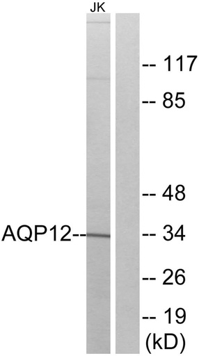 Antibodie to-AQP12 