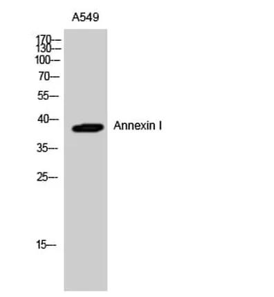 Antibodie to-ANXA1 