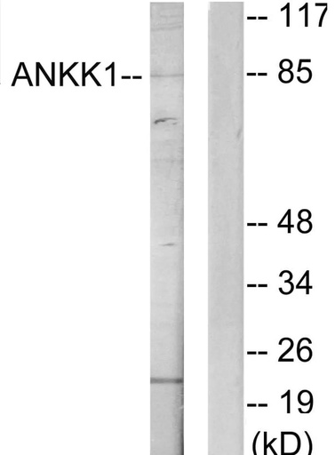 Antibodie to-ANKK1 