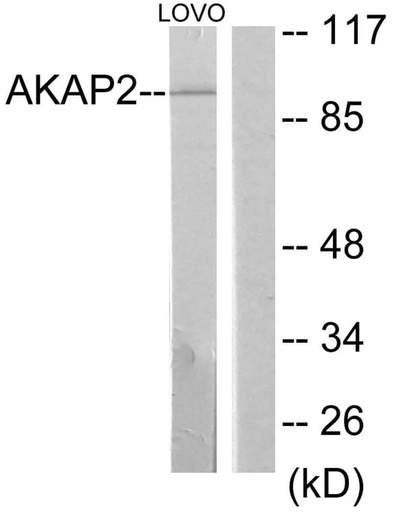 Antibodie to-AKAP2 