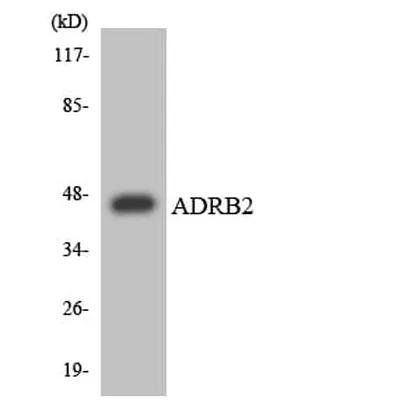 Antibodie to-ADRB2 